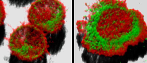 T Lymphocytes