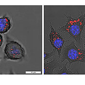 Polymere Nanopartikel (rot) können von Immunzellen (Zellkern blau) aufgefressen und dann von ihnen abgebaut werden (links). Wenn sie mit einem Immunstimulanz beladen sind, wecken sie die Immunzellen aus ihrem Schlaf (rechts).