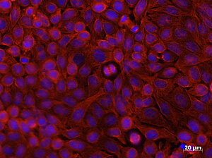 Mausfibroblasten unter dem Fluores-zenzmikroskop