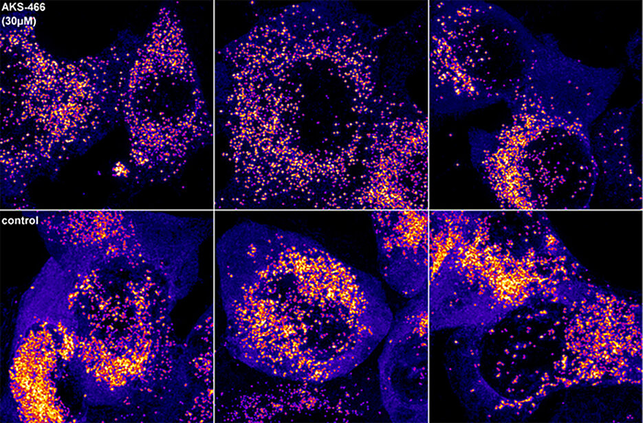 The cells in the top row were treated with the fluoxetine-like molecule AKS466 and then infected with SARS-CoV-2. The cells at the bottom were only infected; more viral RNA is detectable in them (lighter dots).