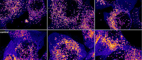 The cells in the top row were treated with the fluoxetine-like molecule AKS466 and then infected with SARS-CoV-2. The cells at the bottom were only infected; more viral RNA is detectable in them (lighter dots). (Image: Jan Schlegel / Universität Würzburg)